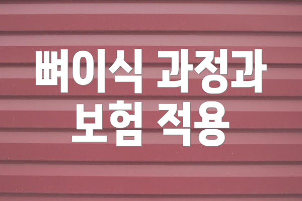 뼈이식 과정과 보험 적용